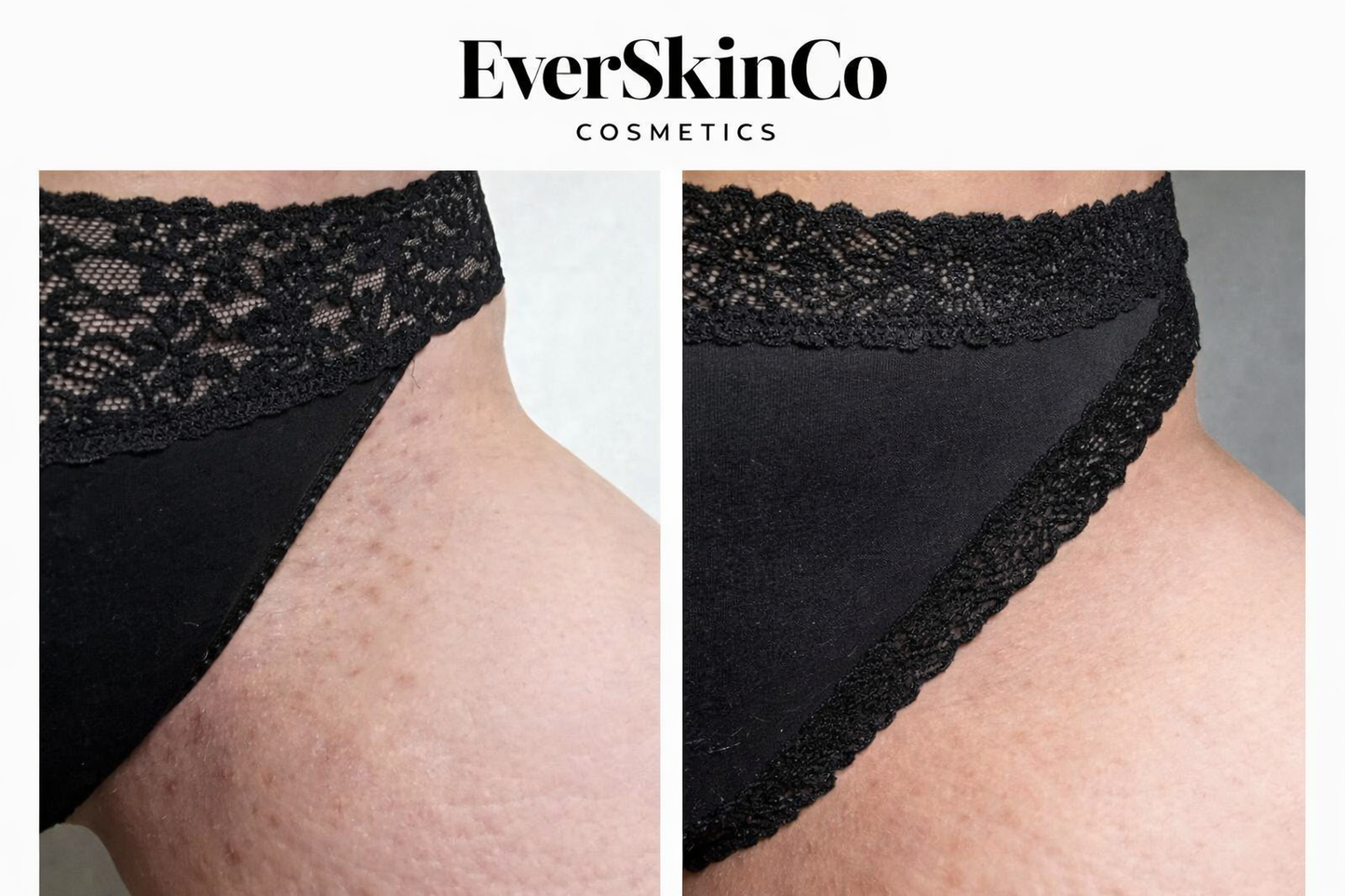 Kojic Acid Turmeric Vita Brightening Body Wash