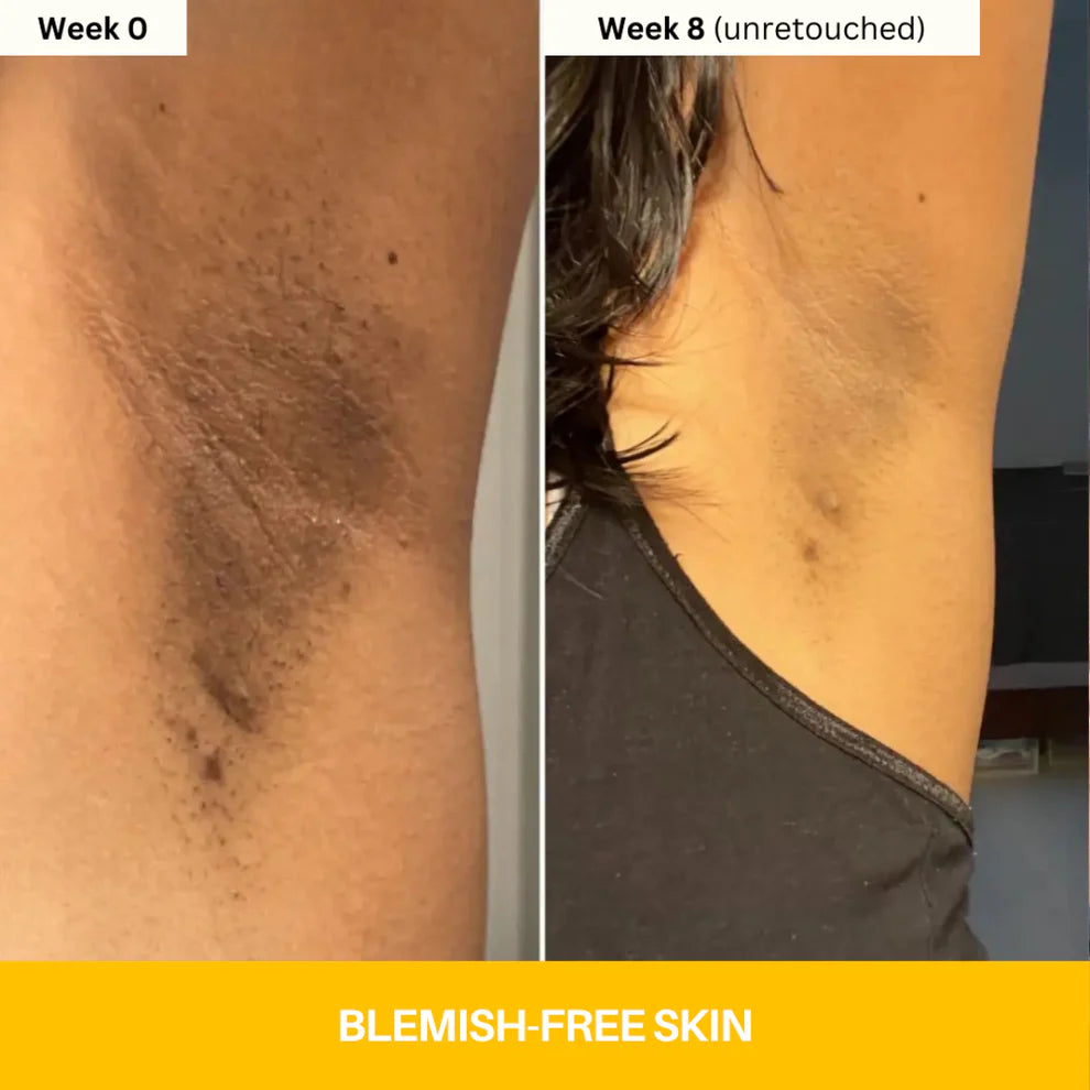 Kojic Acid Turmeric Vita Brightening Body Wash